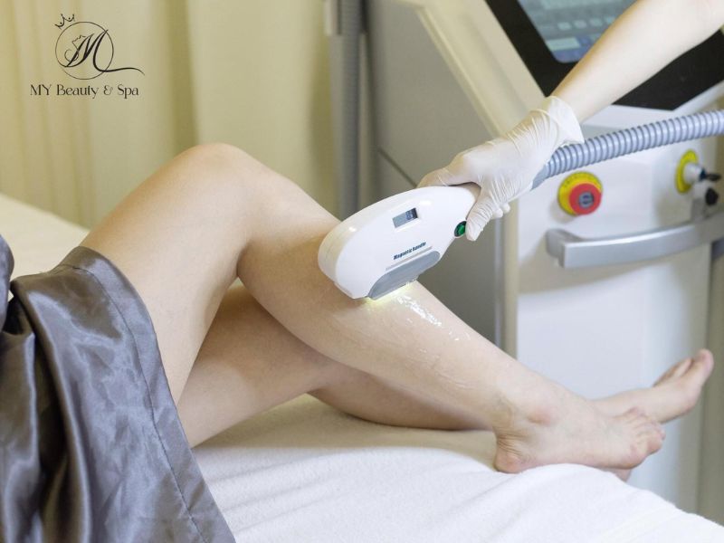 Trải nghiệm triệt lông công nghệ Diode Laser tại My Beauty Spa